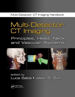 Download Multi-Detector CT Imaging: Principles, Head, Neck, and Vascular Systems (Multi-Detector CT Imaging Handbook) - Luca Saba file in PDF