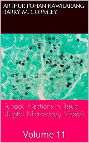 Download Fungal Infections in Tissue (Digital Microscopy Video): Volume 11 - Arthur Pohan Kawilarang | PDF