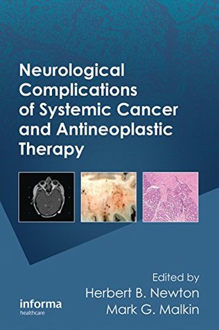 Read Online Neurological Complications of Systemic Cancer and Antineoplastic Therapy: 96 (Neurological Disease and Therapy) - Herbert B. Newton | ePub