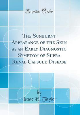 Read Online The Sunburnt Appearance of the Skin as an Early Diagnostic Symptom of Supra Renal Capsule Disease (Classic Reprint) - Isaac Ebenezer Taylor file in ePub