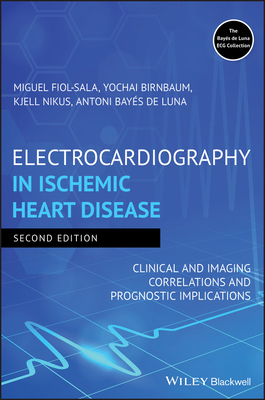 Read Electrocardiography in Ischemic Heart Disease: Clinical and Imaging Correlations and Prognostic Implications - Miguel Fiol-Sala | ePub